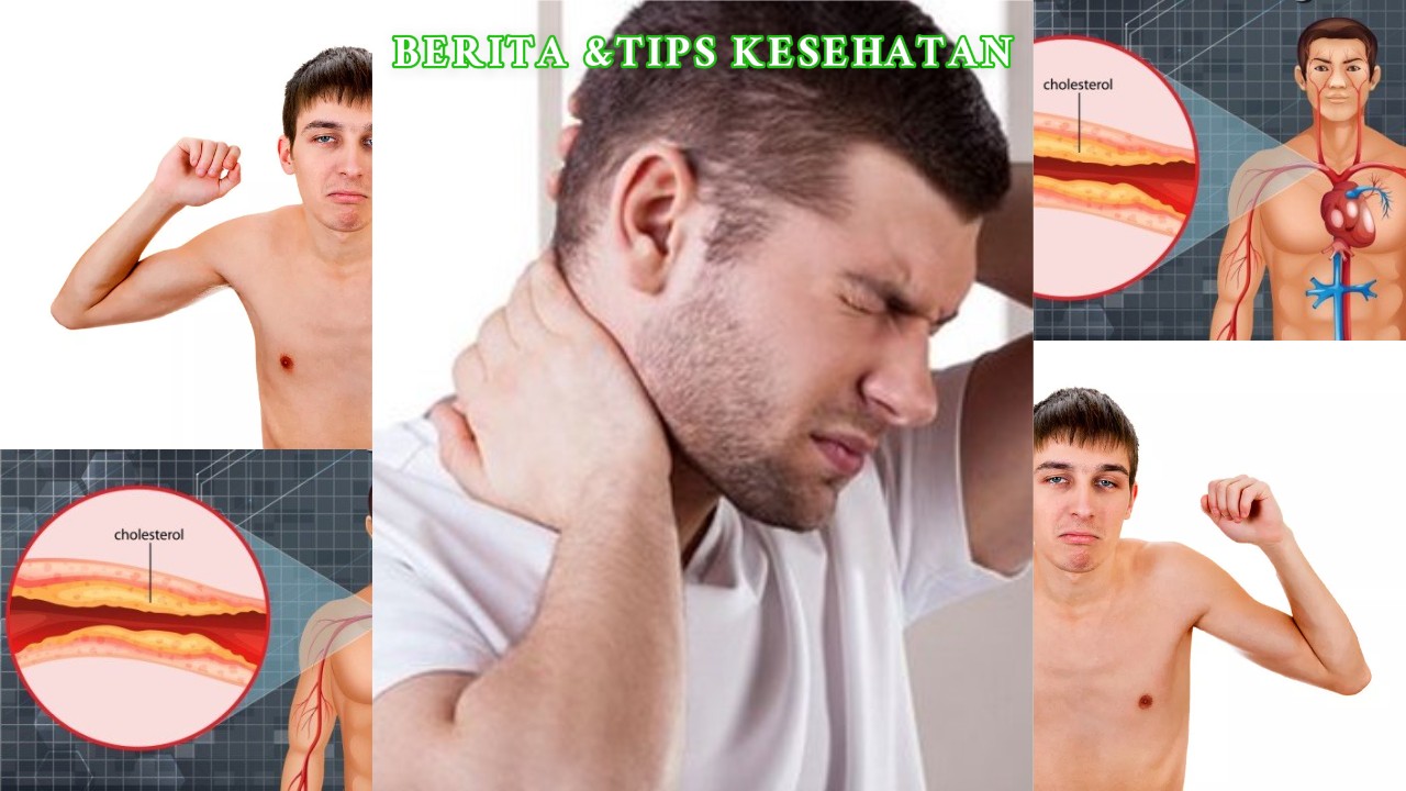 Kolesterol Orang Kurus Juga Bisa Kena , Ini Sebabnya