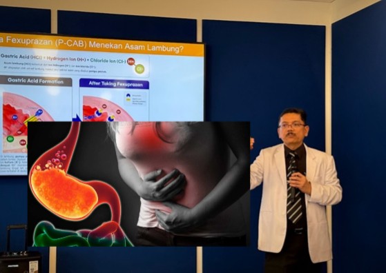 Obat Baru P-CAB Efektif Redakan GERD Lebih Cepat