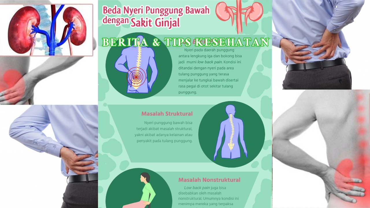 Bedakan Sakit Punggung karena Postur Buruk dan Masalah Ginjal