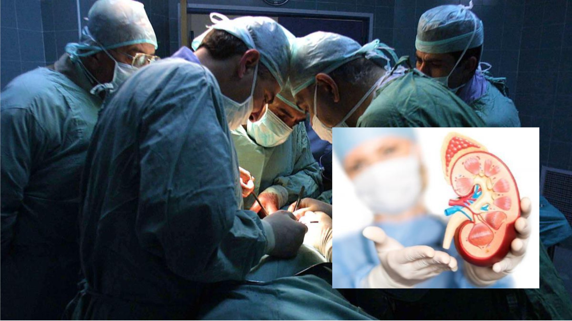 Transplantasi Ginjal Dapat Tingkatkan Harapan Hidup Pasien