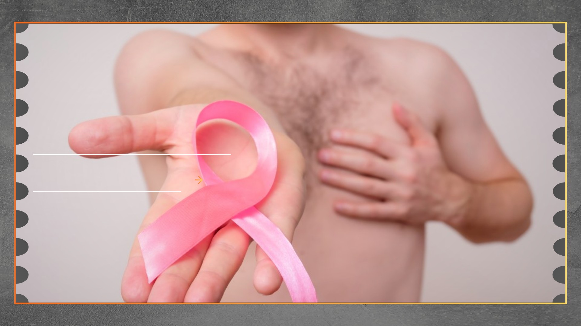 Kanker Payudara pada Pria, Kenali Gejala Awalnya