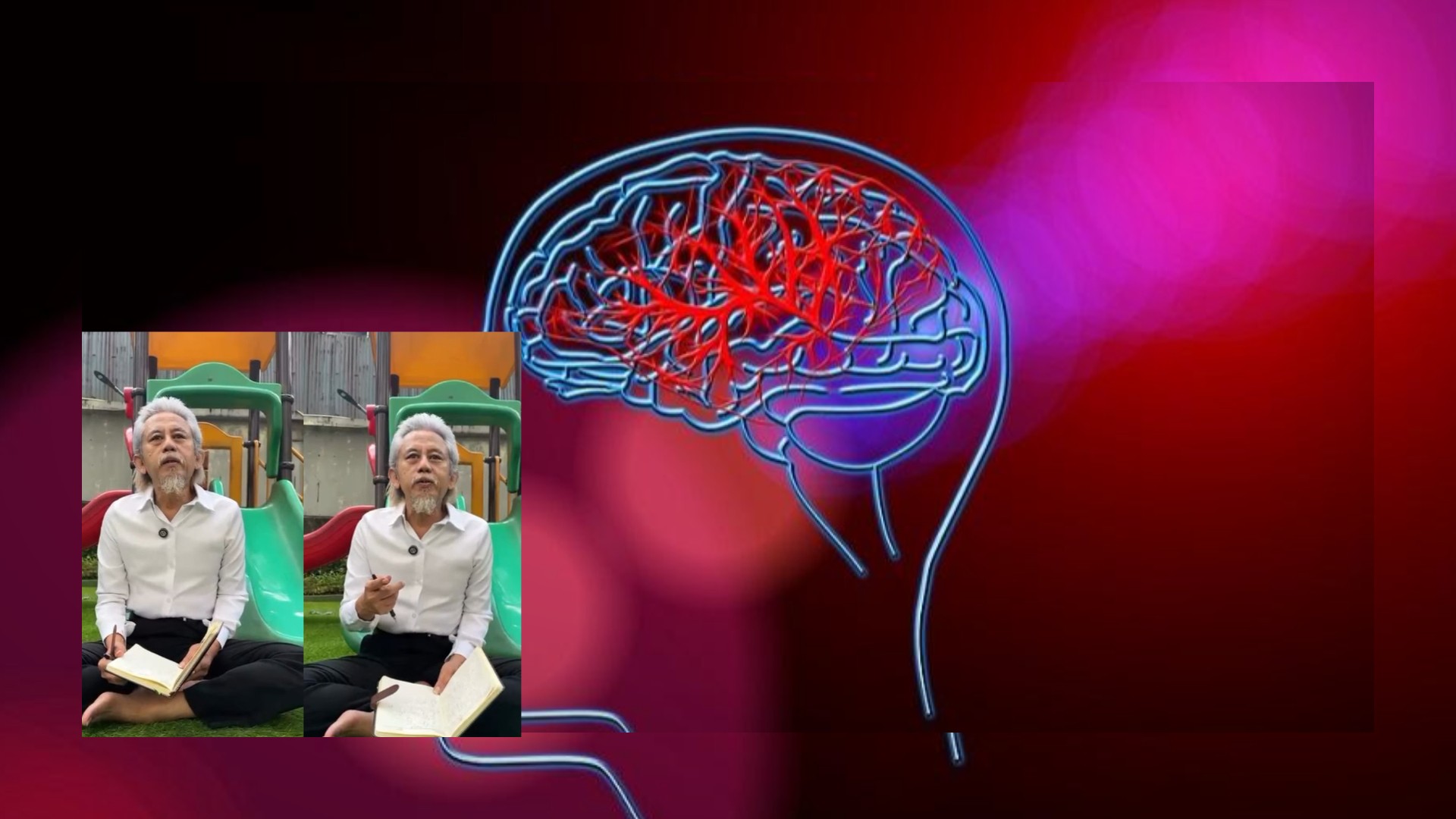 Waspadai Pecah Pembuluh Darah Otak dan 8 Gejalanya