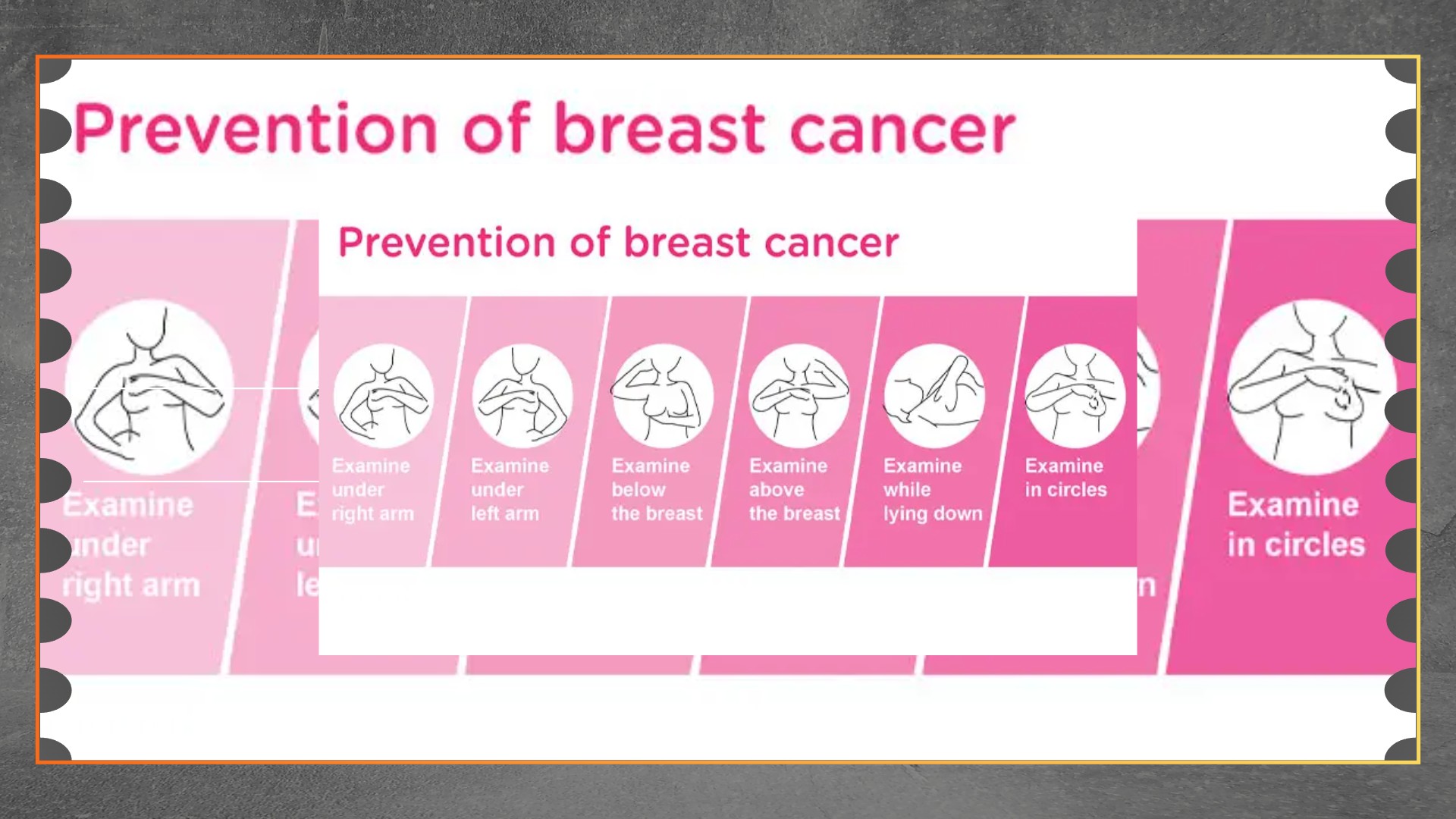 Cara Mencegah Kanker Payudara dengan 5 Langkah Sederhana