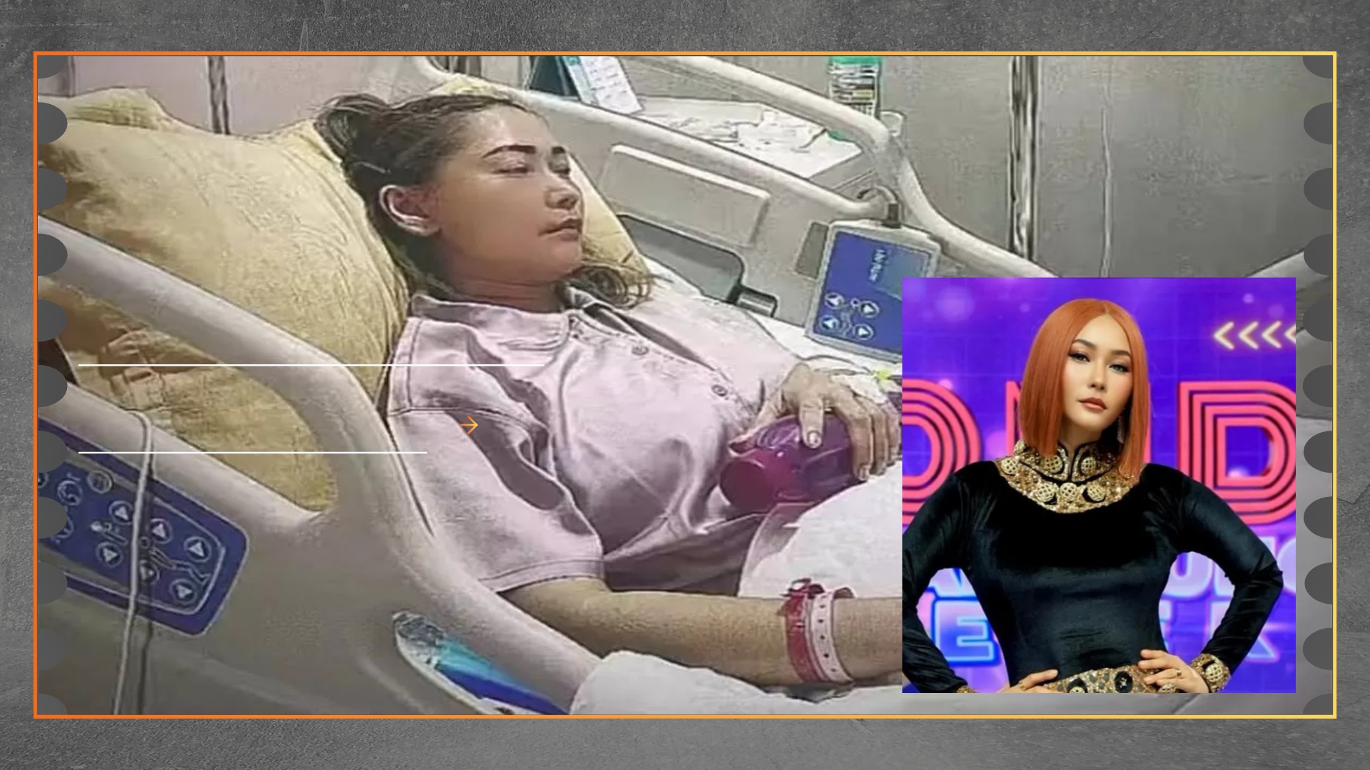 Inul Daratista Pingsan, Alami Gangguan Pencernaan